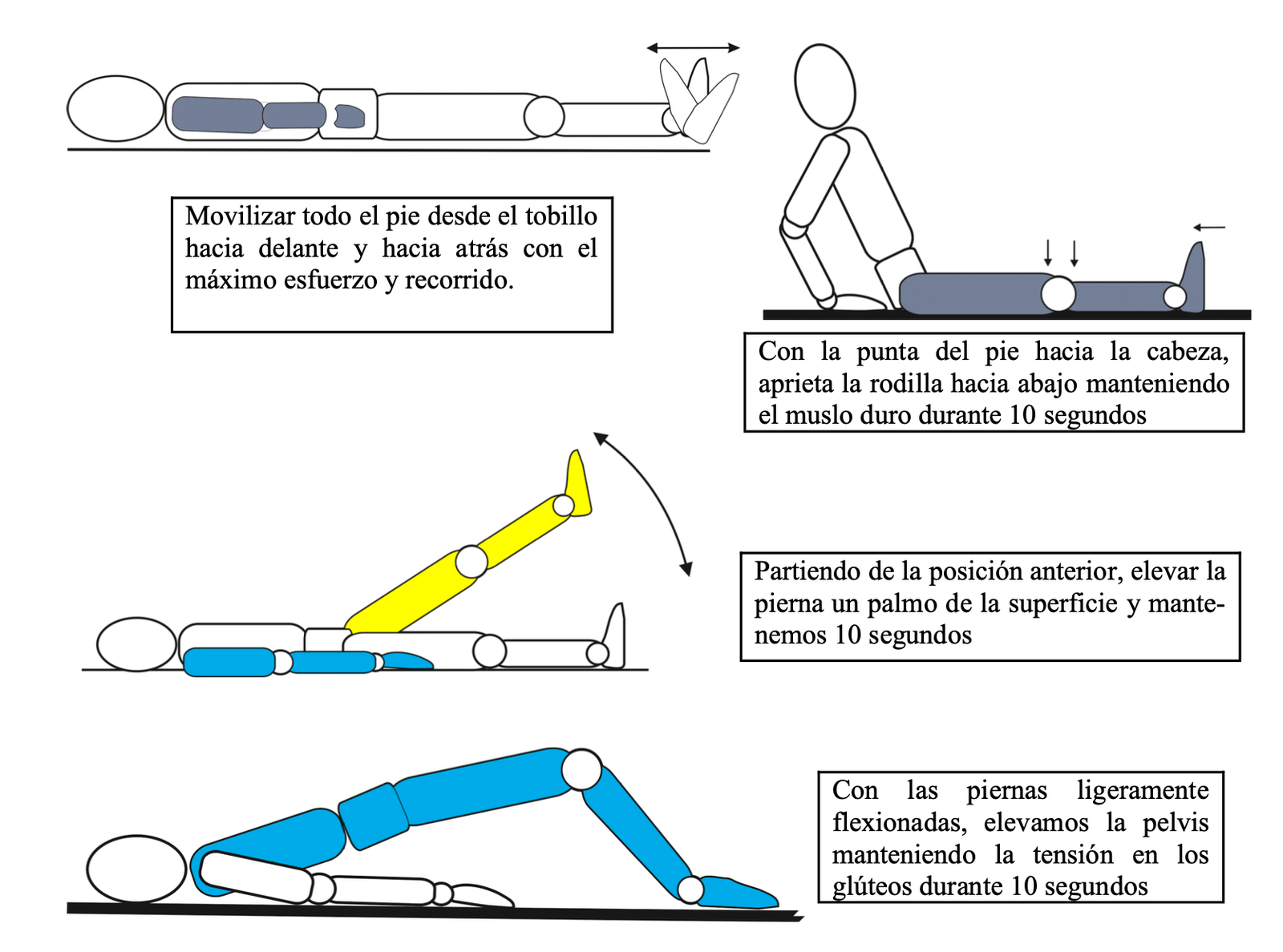 Artroscopia de Rodilla. Recuperación operacion ligamento cruzado anterior